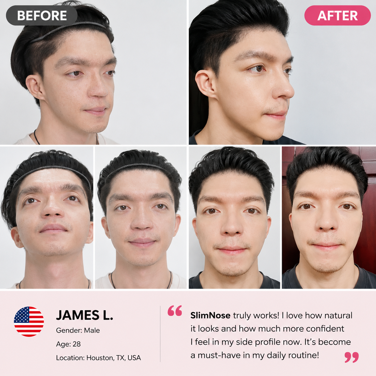 Nose Shaper Invisible